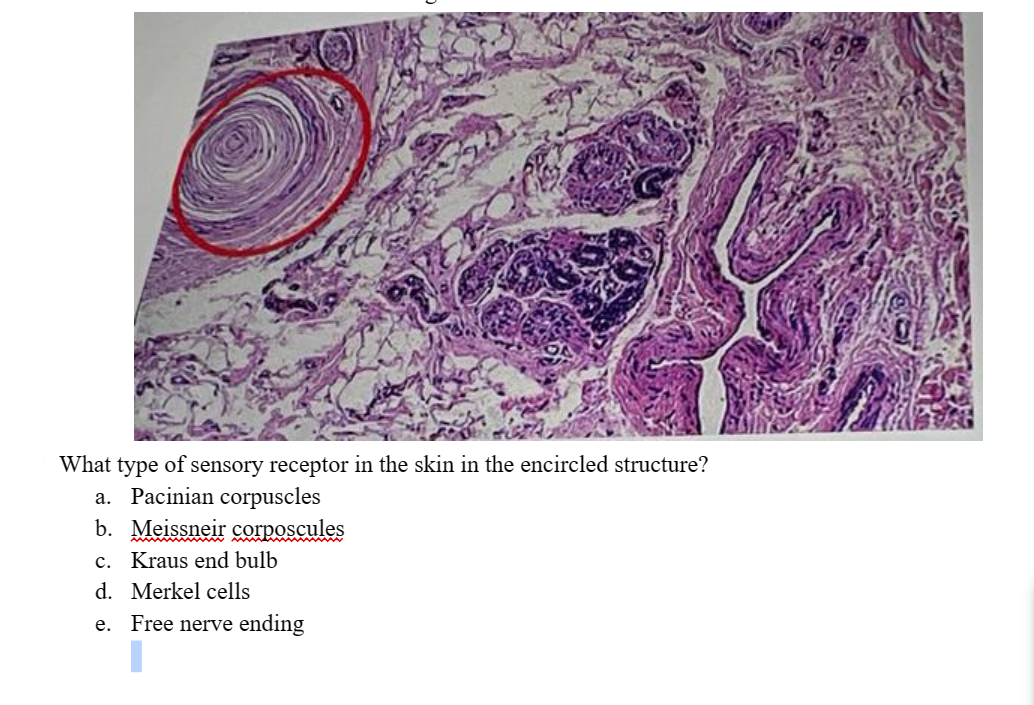 What type of sensory receptor in the skin in the encircled structure?
a. Pacinian corpuscles
b. Meissneir corposcules
c. Kraus end bulb
d. Merkel cells
e.
Free nerve ending