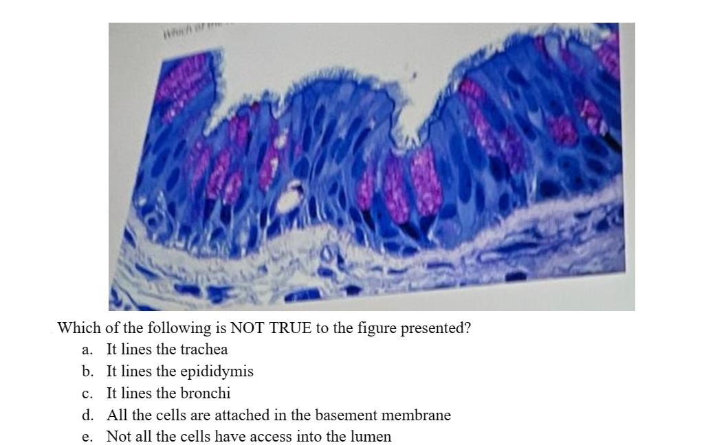 Which of t
Which of the following is NOT TRUE to the figure presented?
a. It lines the trachea
b. It lines the epididymis
c. It lines the bronchi
d. All the cells are attached in the basement membrane
e.
Not all the cells have access into the lumen
