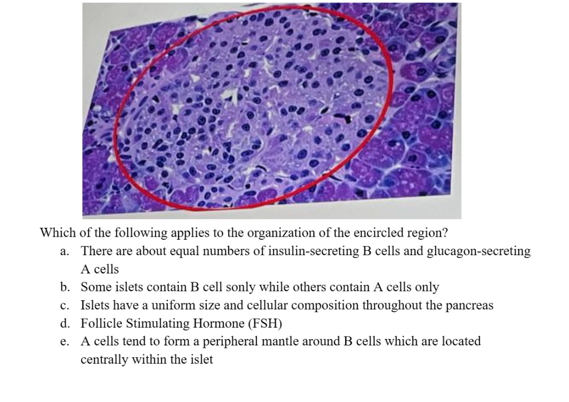 Which of the following applies to the organization of the encircled region?
a. There are about equal numbers of insulin-secreting B cells and glucagon-secreting
A cells
b. Some islets contain B cell sonly while others contain A cells only
c. Islets have a uniform size and cellular composition throughout the pancreas
d. Follicle Stimulating Hormone (FSH)
e. A cells tend to form a peripheral mantle around B cells which are located
centrally within the islet