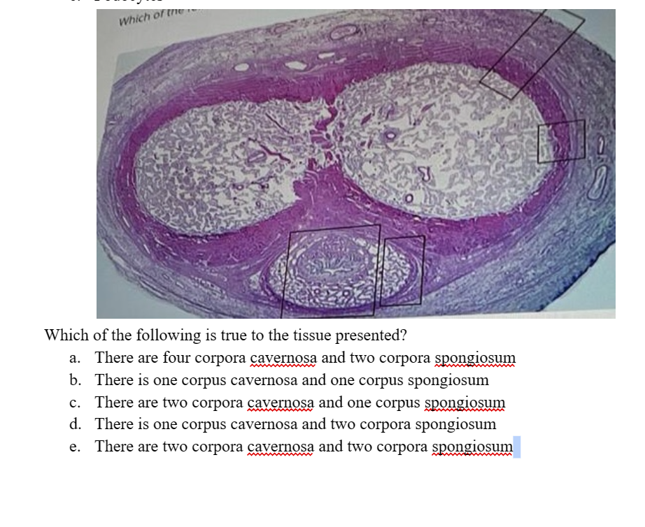 Which of the
Which of the following is true to the tissue presented?
a. There are four corpora cavernosa and two corpora spongiosum
b. There is one corpus cavernosa and one corpus spongiosum
c. There are two corpora cavernosa and one corpus spongiosum
d. There is one corpus cavernosa and two corpora spongiosum
e. There are two corpora cavernosa and two corpora spongiosum