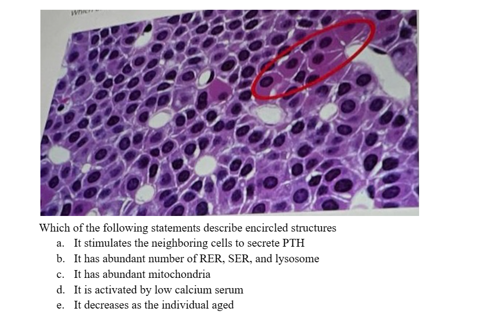 Which
Which of the following statements describe encircled structures
a. It stimulates the neighboring cells to secrete PTH
b. It has abundant number of RER, SER, and lysosome
c. It has abundant mitochondria
d. It is activated by low calcium serum
e. It decreases as the individual aged