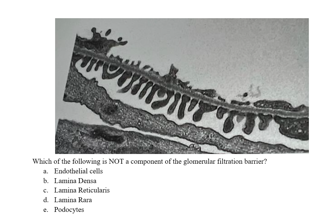 Which of the following is NOT a component of the glomerular filtration barrier?
a. Endothelial cells
b. Lamina Densa
c. Lamina Reticularis
d. Lamina Rara
e. Podocytes