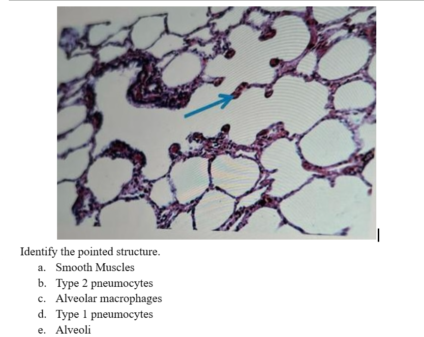 Identify the pointed structure.
a. Smooth Muscles
b. Type 2 pneumocytes
c. Alveolar macrophages
d. Type 1 pneumocytes
e. Alveoli