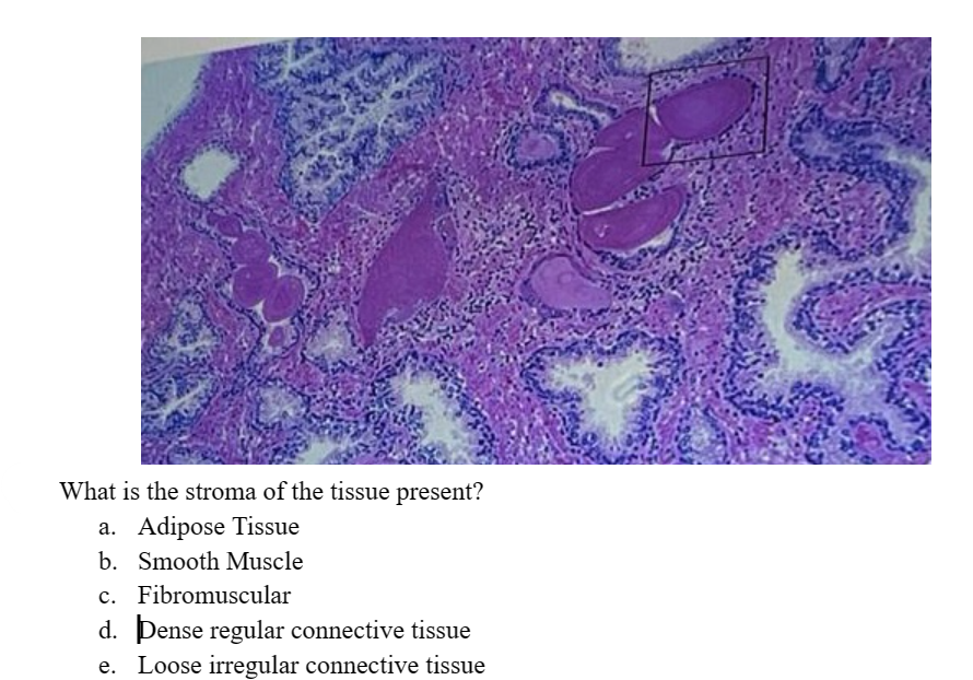 What is the stroma of the tissue present?
a. Adipose Tissue
b. Smooth Muscle
c. Fibromuscular
d. Dense regular connective tissue
Loose irregular connective tissue
