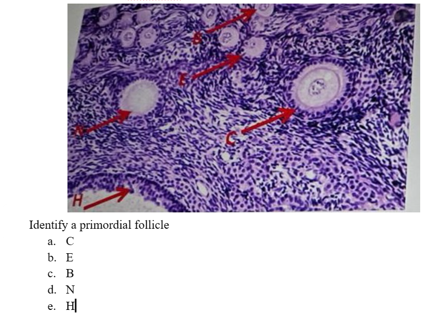 Identify a primordial follicle
a. C
b. E
C. B
d. N
e.
H