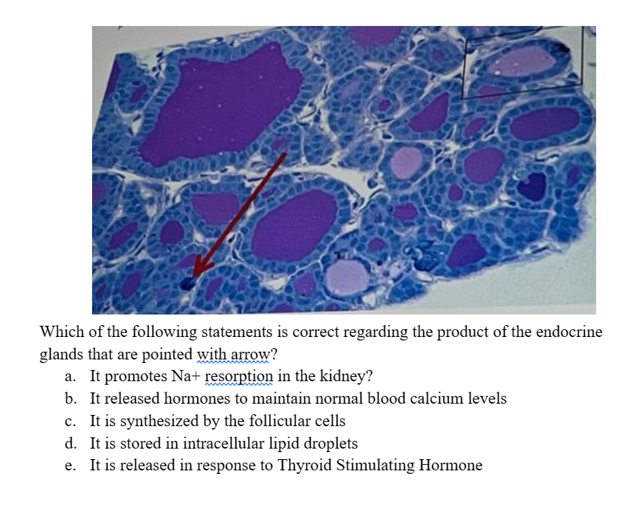 Which of the following statements is correct regarding the product of the endocrine
glands that are pointed with arrow?
a. It promotes Na+ resorption in the kidney?
b. It released hormones to maintain normal blood calcium levels
c. It is synthesized by the follicular cells
d. It is stored in intracellular lipid droplets
e. It is released in response to Thyroid Stimulating Hormone