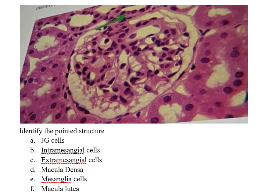 Identity
Identify the pointed structure
a. JG cells
b. Intramesangial cells
c. Extramesangial cells
d. Macula Densa
e. Mesanglia cells
f. Macula lutea