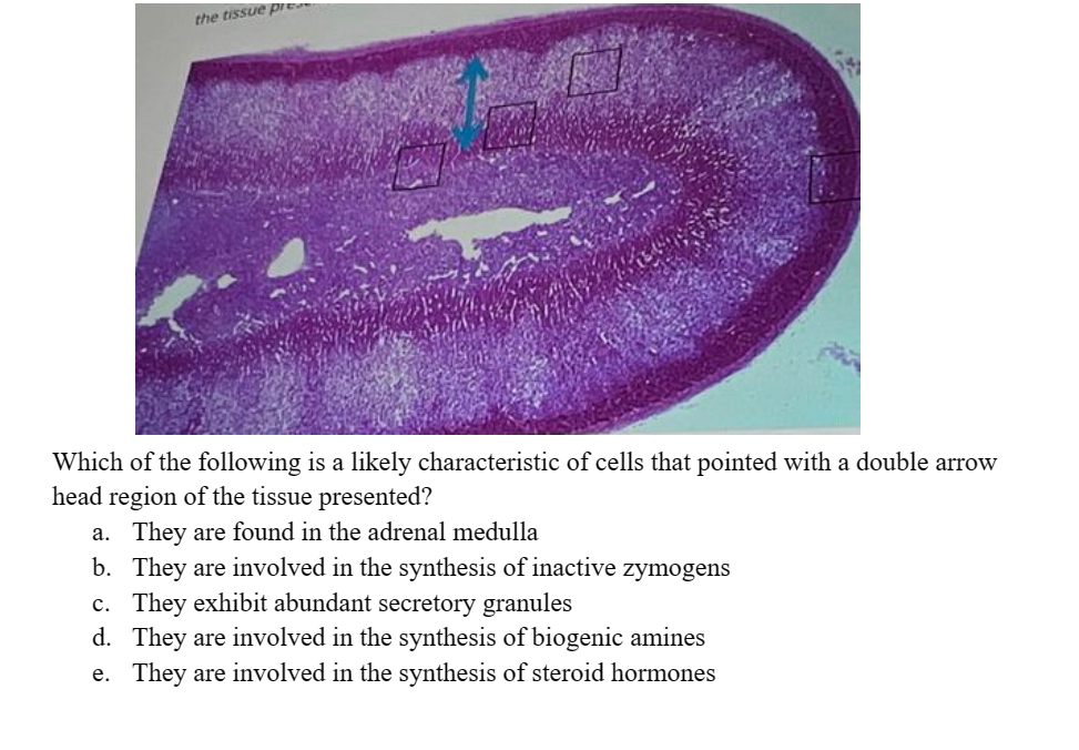 the tissue pre
Which of the following is a likely characteristic of cells that pointed with a double arrow
head region of the tissue presented?
a. They are found in the adrenal medulla
b. They are involved in the synthesis of inactive zymogens
c. They exhibit abundant secretory granules
d. They are involved in the synthesis of biogenic amines
e. They are involved in the synthesis of steroid hormones