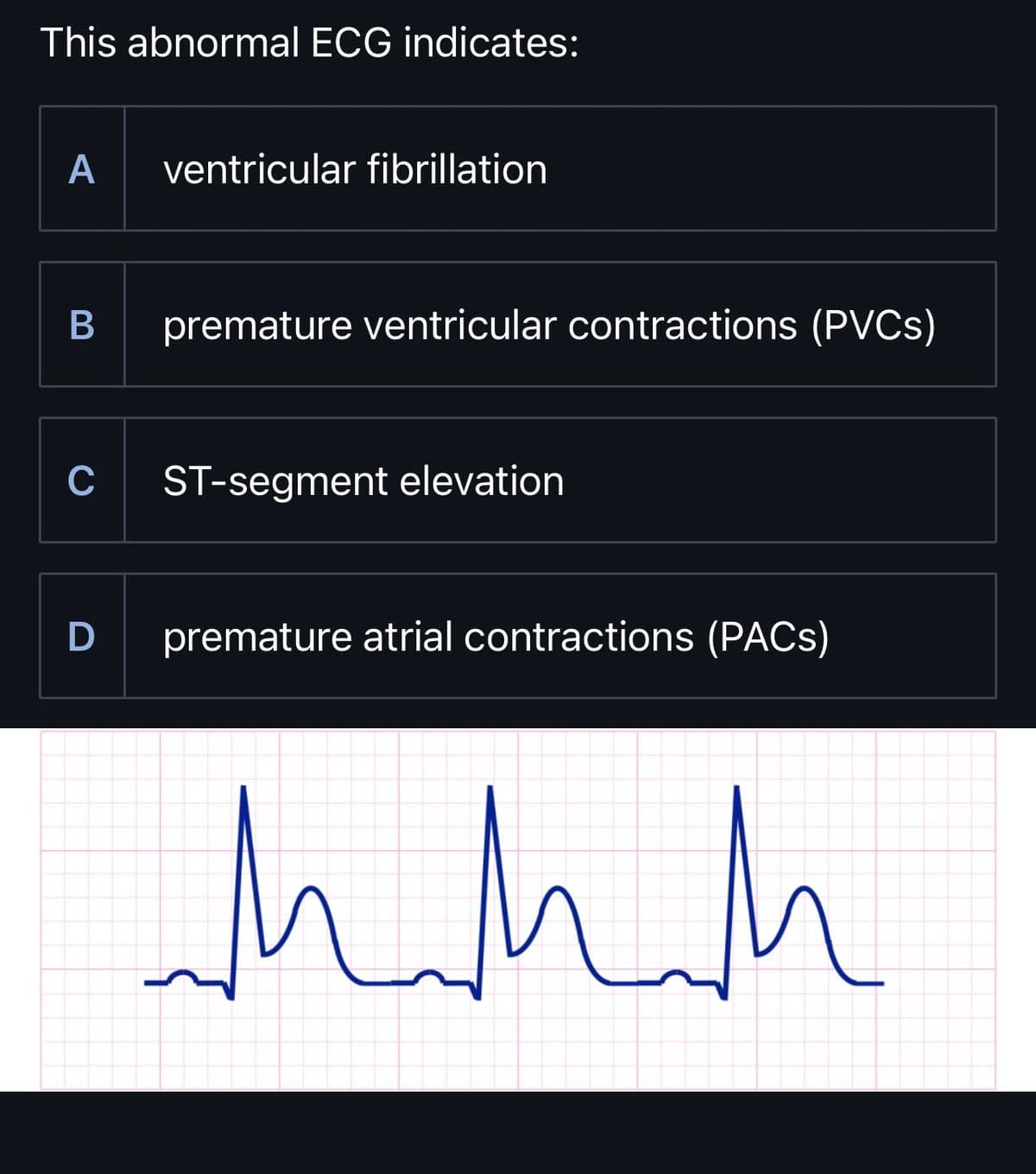 This abnormal ECG indicates:
A
ventricular fibrillation
B
premature ventricular contractions (PVCs)
C ST-segment elevation
D premature atrial contractions (PACS)
hahah