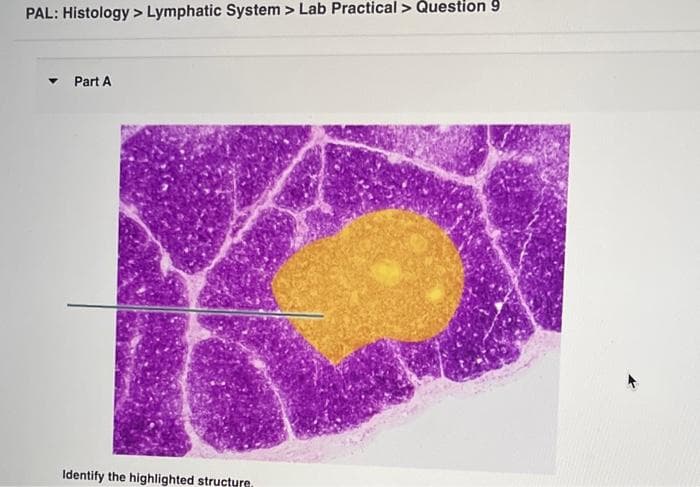 PAL: Histology > Lymphatic System > Lab Practical > Question 9
Part A
Identify the highlighted structure.