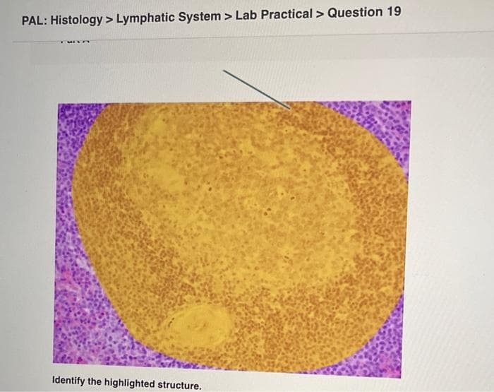 PAL: Histology > Lymphatic System
Identify the highlighted structure.
> Lab Practical > Question 19