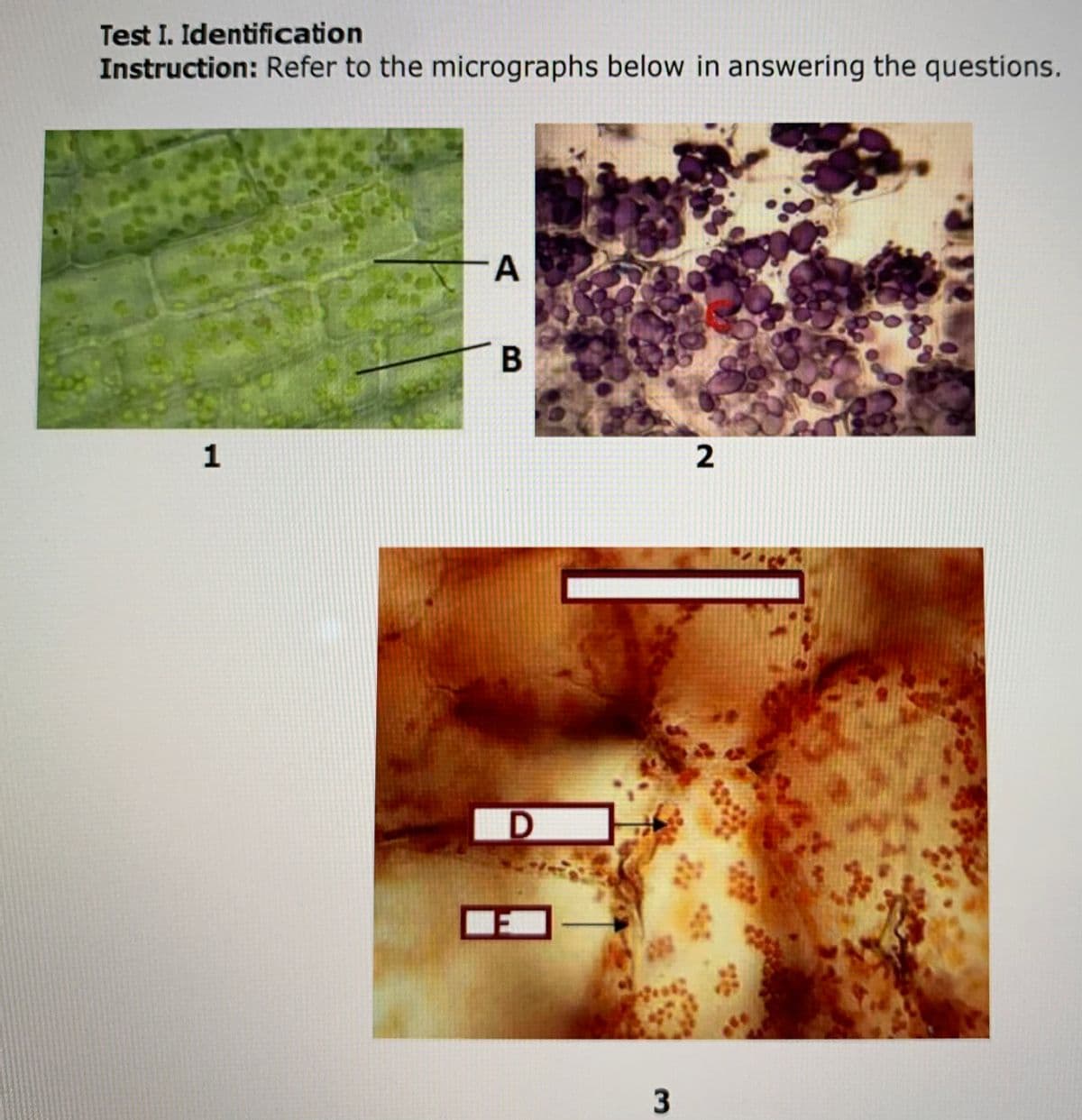 Test I. Identification
Instruction: Refer to the micrographs below in answering the questions.
EST
B
1
3.
