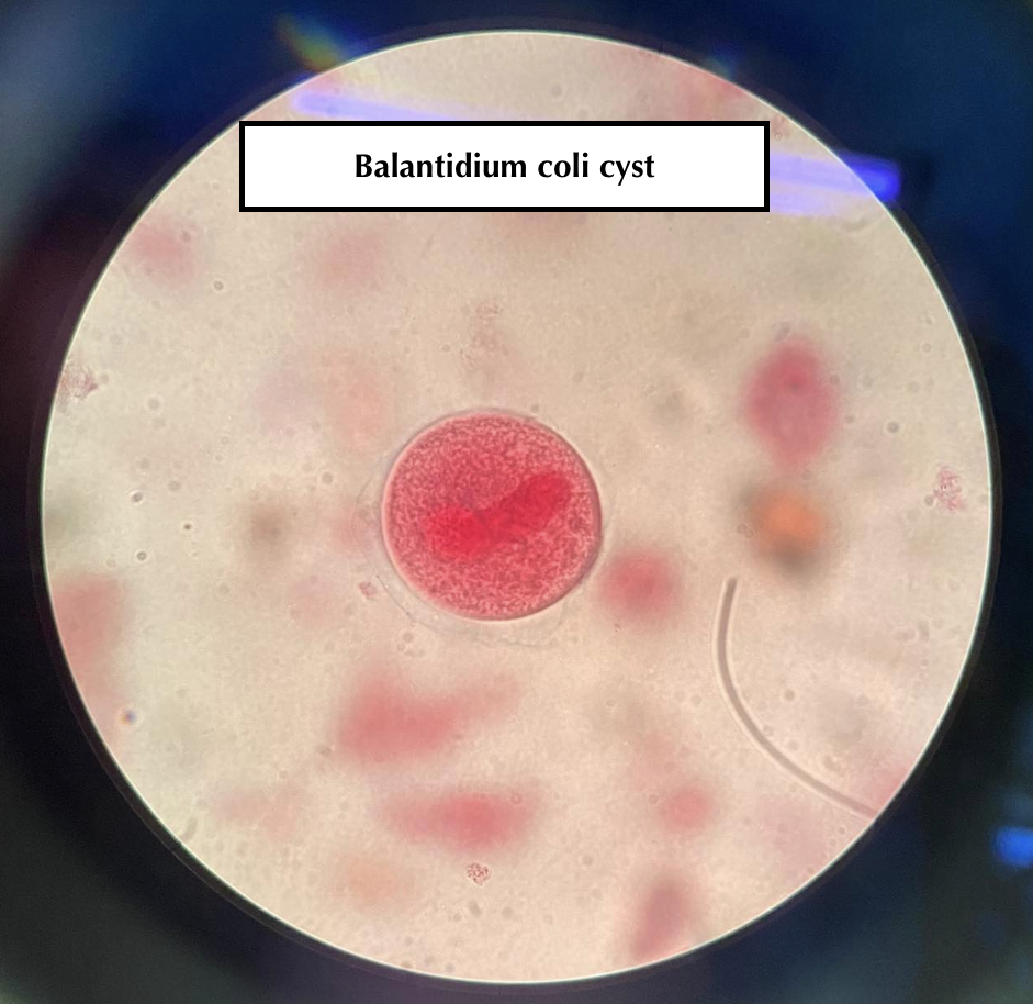 Balantidium coli cyst
A