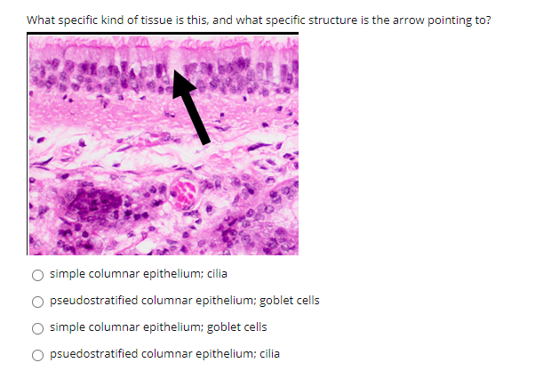 What specific kind of tissue is this, and what specific structure is the arrow pointing to?
simple columnar epithelium; cilia
pseudostratified columnar epithelium; goblet cells
O simple columnar epithelium; goblet cells
psuedostratified columnar epithelium; cilia
