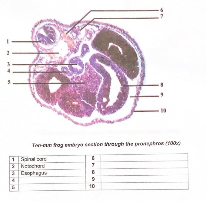 N
5
1 Spinal cord
2
3
45
Notochord
Esophagus
Ten-mm frog embryo section through the pronephros (100x)
6
7
8
9
6
7
10
8
10