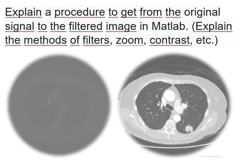 Explain a procedure to get from the original
signal to the filtered image in Matlab. (Explain
the methods of filters, zoom, contrast, etc.)
Activar Windows