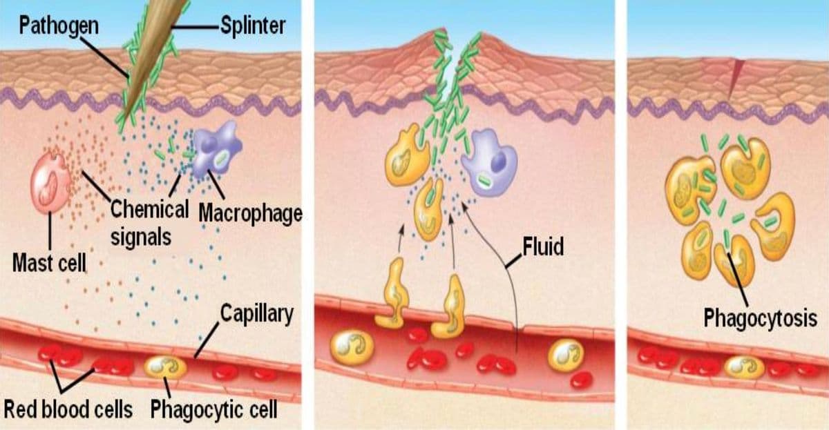 Pathogen
-Splinter
Chemical Macrophage
signals
Fluid
Mast cell
Capillary
Phagocytosis
Red blood cells Phagocytic cell
