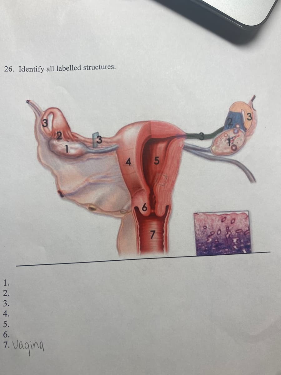 26. Identify all labelled structures.
1.
2.
3.
4.
5.
6.
7. Vagina
6
5
7