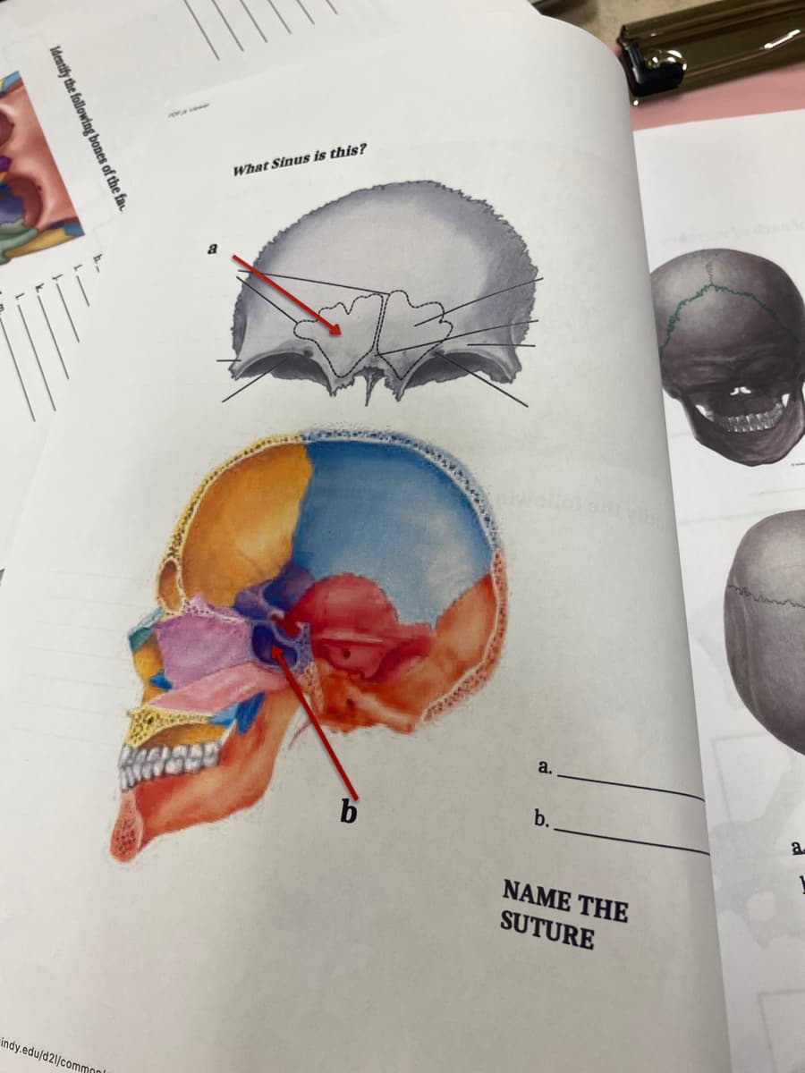 Identify the following bones of the fac
indy.edu/d21/commonl
What Sinus is this?
b
a.
b.
siti vis
NAME THE
SUTURE
a.