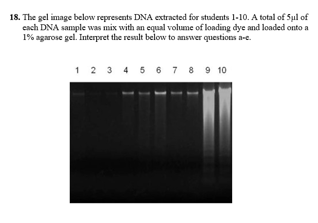 18. The gel image below represents DNA extracted for students 1-10. A total of 5µl of
each DNA sample was mix with an equal volume of loading dye and loaded onto a
1% agarose gel. Interpret the result below to answer questions a-e.
1 2 3 4 5 6 7 8 9 10
