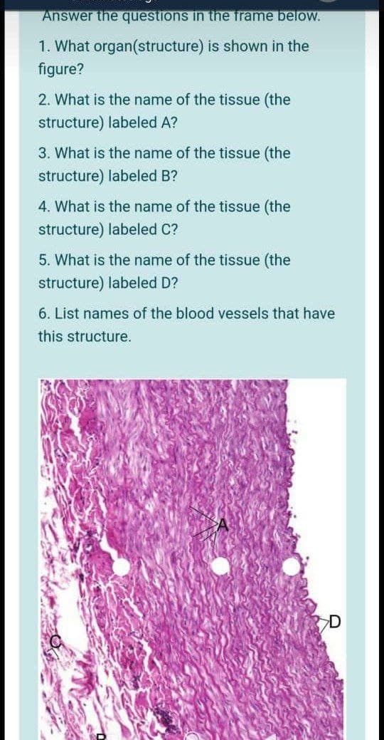 Answer the questions in the frame below.
1. What organ(structure) is shown in the
figure?
2. What is the name of the tissue (the
structure) labeled A?
3. What is the name of the tissue (the
structure) labeled B?
4. What is the name of the tissue (the
structure) labeled C?
5. What is the name of the tissue (the
structure) labeled D?
6. List names of the blood vessels that have
this structure.
D