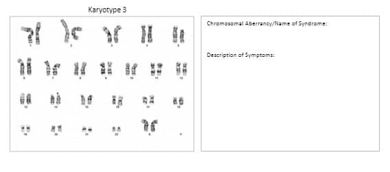 Karyotype 3
Chromosomal Aberrancy/Name of Syndrome:
KEG
DER3
potes
Je
Description of Symptoms:
an
ax
DEI,
210
2011
Set
3221
Chees
in
1245
XE
29
Ww
4
en
Kam
'a