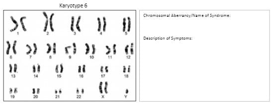X(
13
19
Karyotype 5
2 ( (
}{
} } } }
14
20
16
}}
17
18
Chromosomal Aberrancy/Name of Syndrome:
Description of Symptoms: