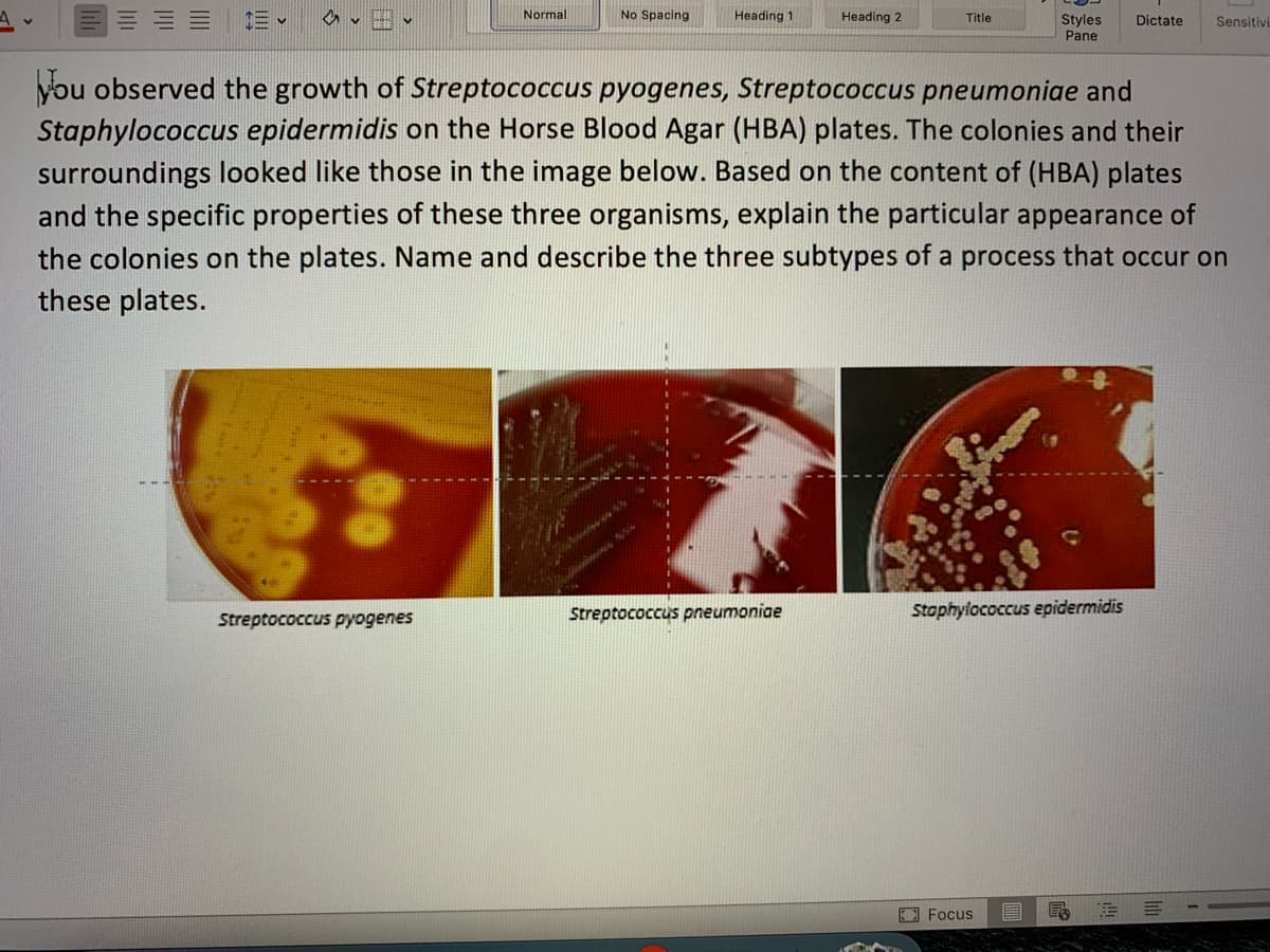Normal
Streptococcus pyogenes
No Spacing
Heading 1
Heading 2
Streptococcus pneumoniae
Title
you observed the growth of Streptococcus pyogenes, Streptococcus pneumoniae and
Staphylococcus epidermidis on the Horse Blood Agar (HBA) plates. The colonies and their
surroundings looked like those in the image below. Based on the content of (HBA) plates
and the specific properties of these three organisms, explain the particular appearance of
the colonies on the plates. Name and describe the three subtypes of a process that occur on
these plates.
Styles Dictate Sensitivi
Pane
Staphylococcus epidermidis
Focus
E
E