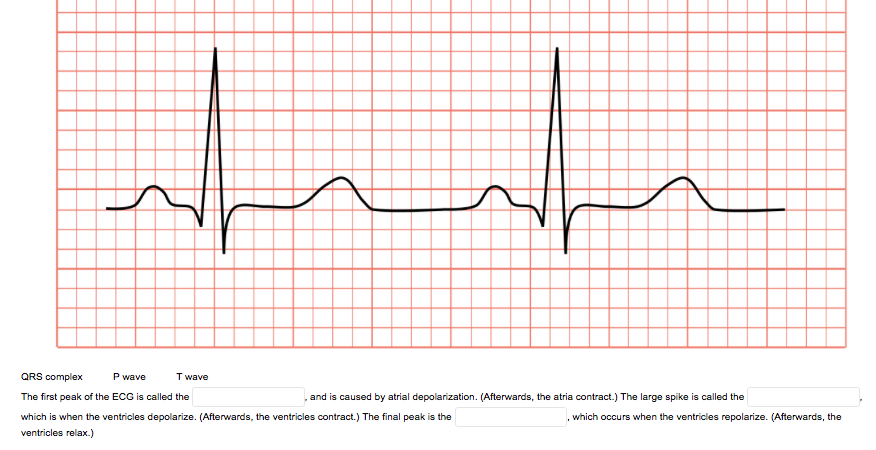 QRS complex
P wave
T wave
The first peak of the ECG is called the
and is caused by atrial depolarization. (Afterwards, the atria contract.) The large spike is called the
which is when the ventricles depolarize. (Afterwards, the ventricles contract.) The final peak is the
,which occurs when the ventricles repolarize. (Afterwards, the
ventricles relax.)

