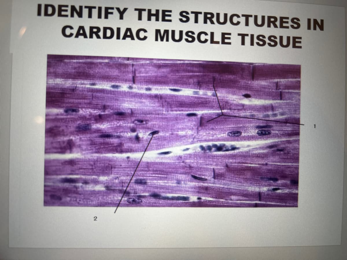 IDENTIFY THE STRUCTURES IN
CARDIAC MUSCLE TISSUE
2