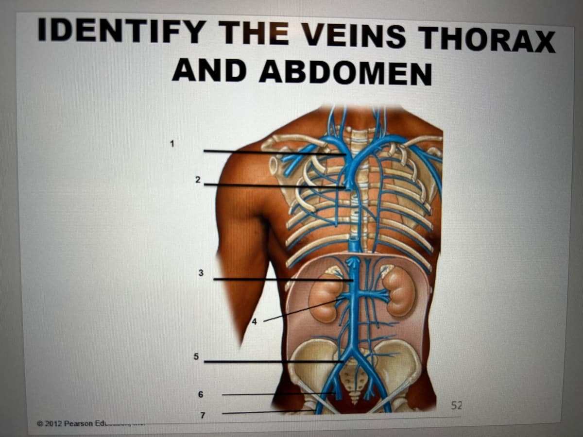 IDENTIFY THE VEINS THORAX
AND ABDOMEN
1
6
52
7
2012 Pearson Ed