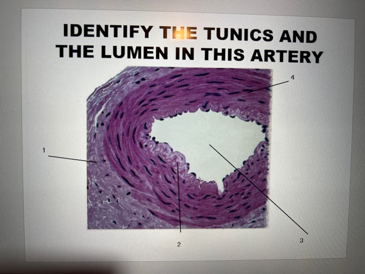 IDENTIFY THE TUNICS AND
THE LUMEN IN THIS ARTERY
4
3
2
