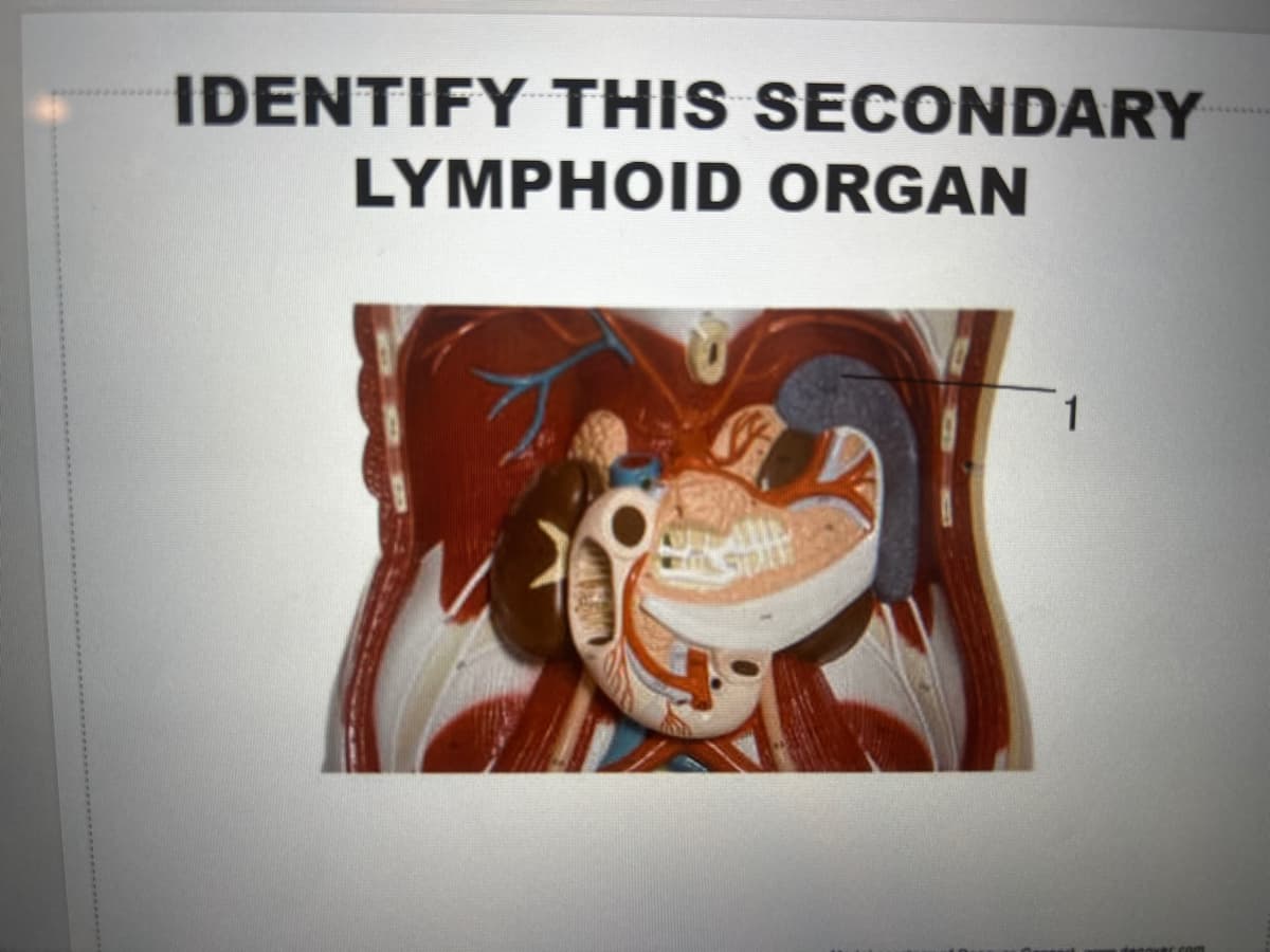 IDENTIFY THIS SECONDARY
LYMPHOID ORGAN
STRAN
1
