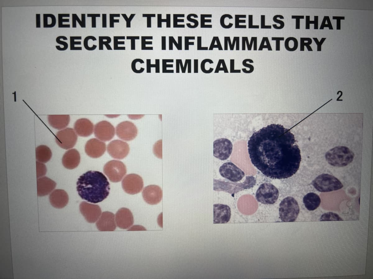 1
IDENTIFY THESE CELLS THAT
SECRETE INFLAMMATORY
CHEMICALS
2