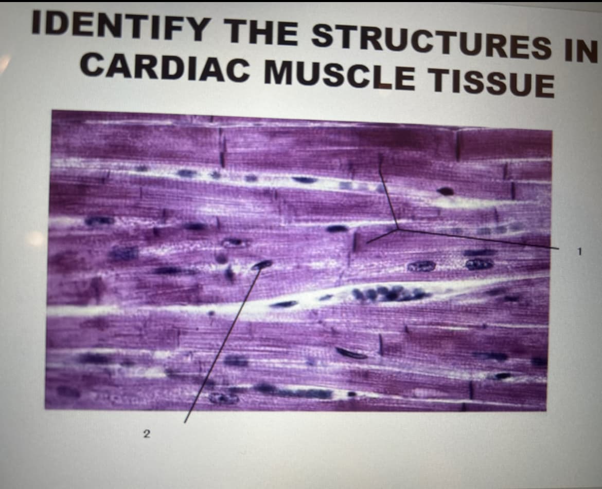 IDENTIFY THE STRUCTURES IN
CARDIAC MUSCLE TISSUE
2