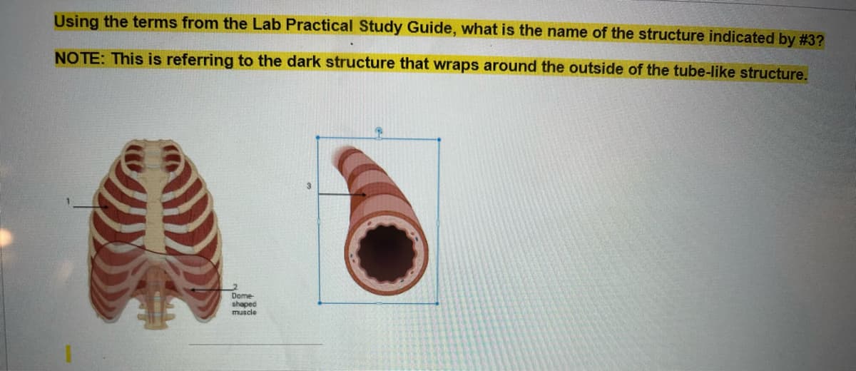 Using the terms from the Lab Practical Study Guide, what is the name of the structure indicated by #3?
NOTE: This is referring to the dark structure that wraps around the outside of the tube-like structure.
Dome-
shaped
muscle