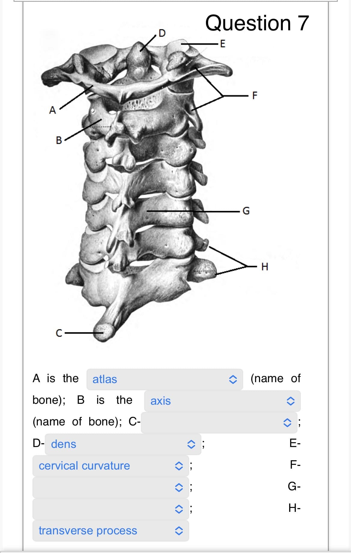 A
B
C
A is the atlas
bone); B is the axis
(name of bone); C-
D- dens
cervical curvature
transverse process
î;
î;
î;
Question 7
E
G
F
H
(name of
E-
F-
G-
H-