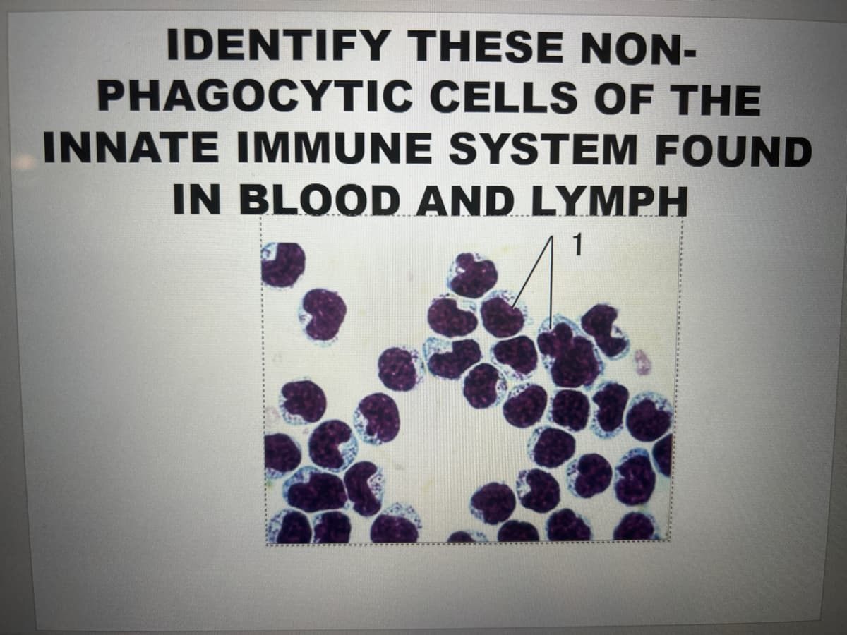 IDENTIFY THESE NON-
PHAGOCYTIC CELLS OF THE
INNATE IMMUNE SYSTEM FOUND
IN BLOOD AND LYMPH
1