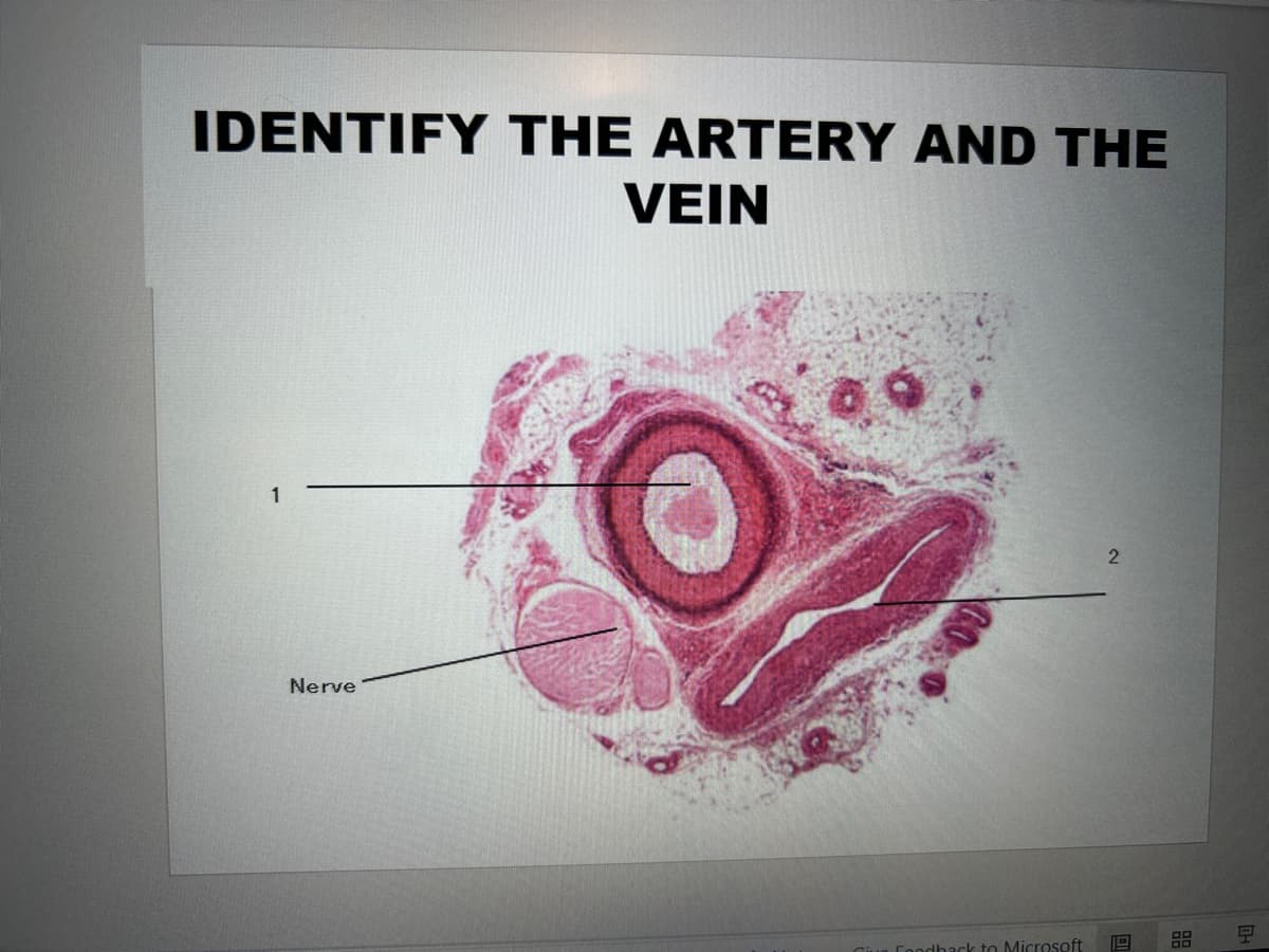 IDENTIFY THE ARTERY AND THE
VEIN
1
Nerve
2
Give Feedback to Microsoft
DI
부