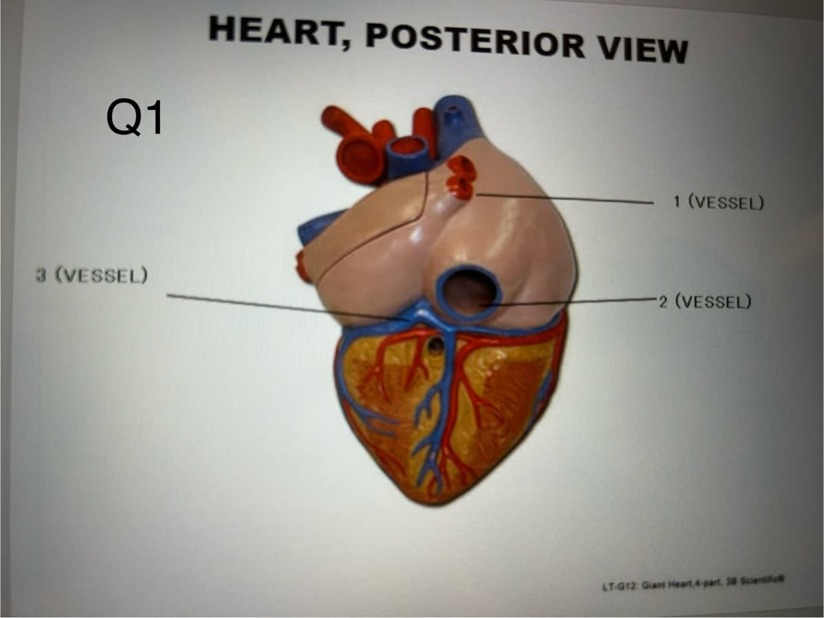 Q1
HEART, POSTERIOR VIEW
3 (VESSEL)
1 (VESSEL)
-2 (VESSEL)
LT-G12 Giant Heart 4-part, 38 Scientific