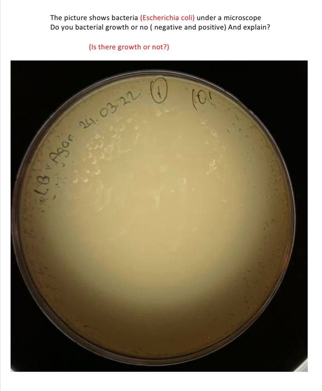 The picture shows bacteria (Escherichia coli) under a microscope
Do you bacterial growth or no ( negative and positive) And explain?
(Is there growth or not?)
24. 03-22
Agar
