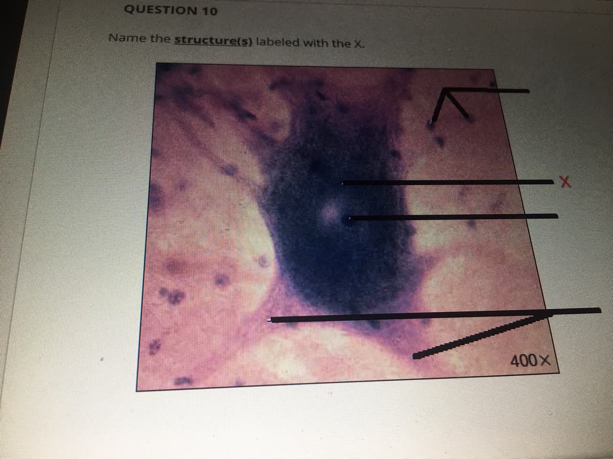 QUESTION 10
Name the structure(s) labeled with the X.
400x
