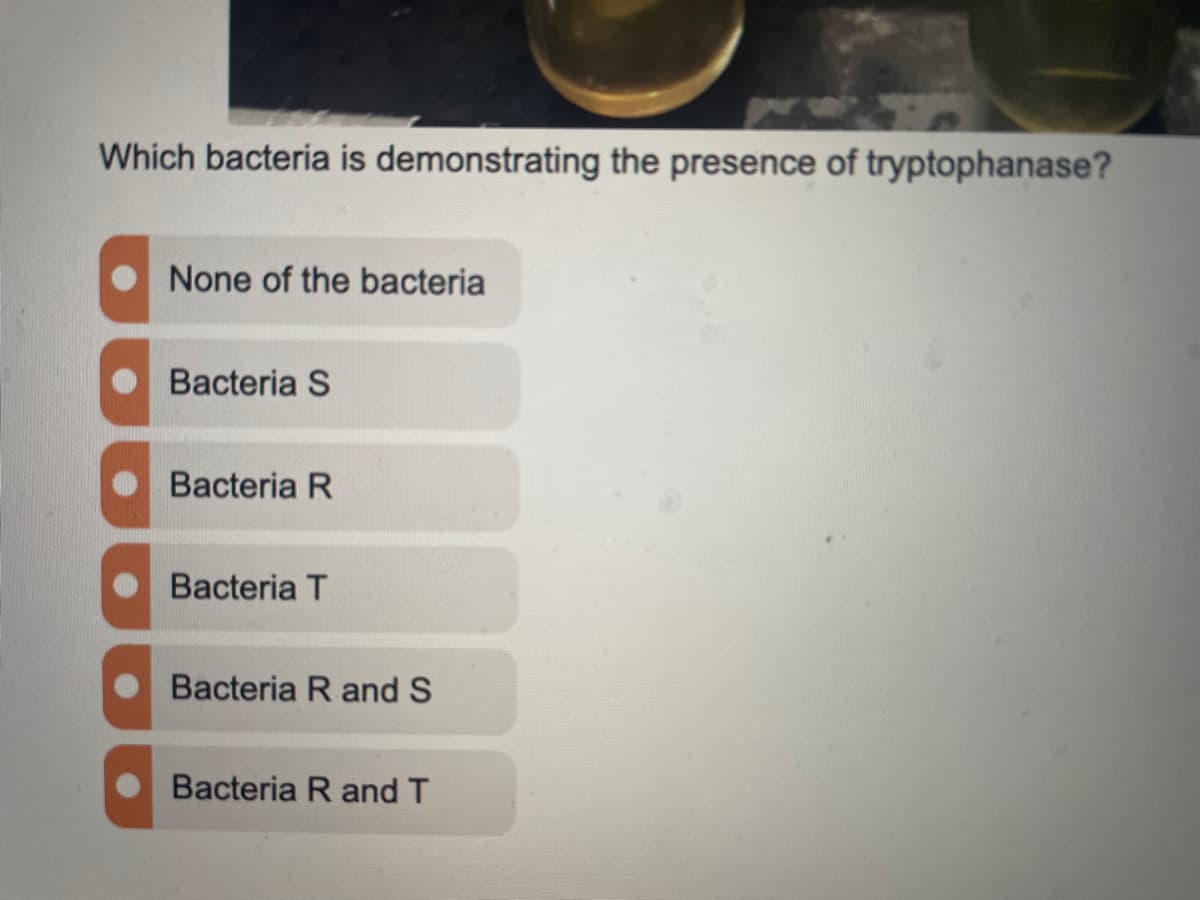 Which bacteria is demonstrating the presence of tryptophanase?
None of the bacteria
Bacteria S
Bacteria R
Bacteria T
Bacteria R and S
Bacteria R and T
