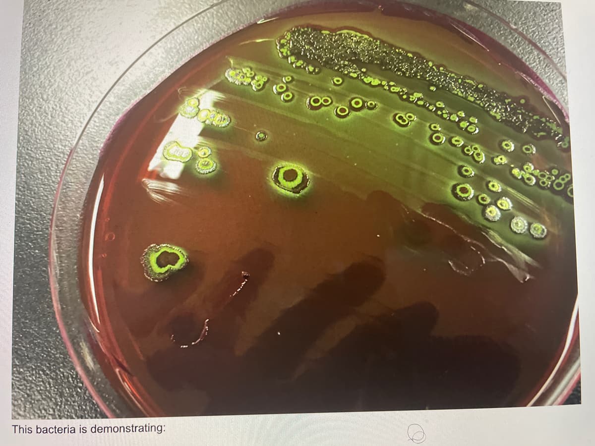 This bacteria is demonstrating:
