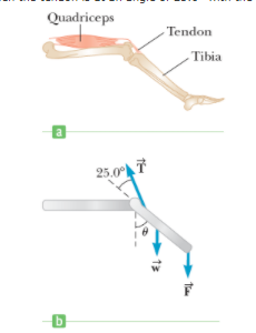 Quadriceps
Tendon
Tibia
a
25.0°T
13
