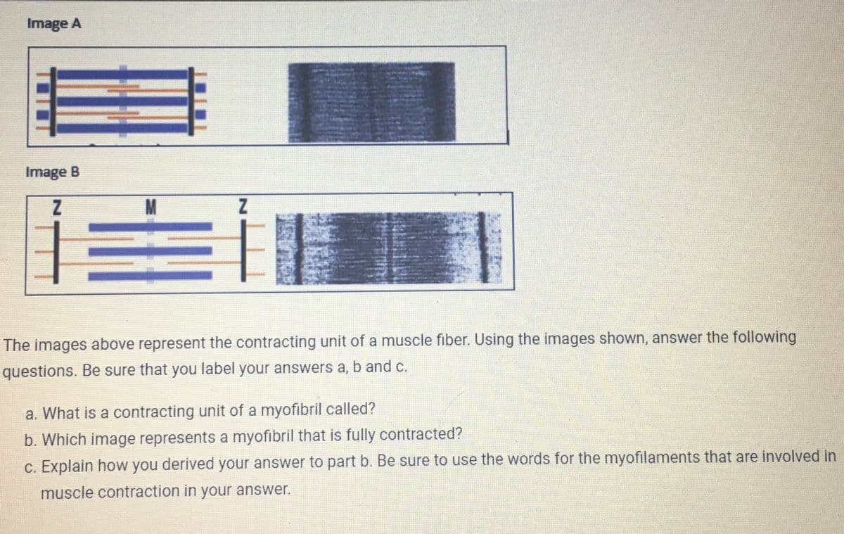 Image A
Image B
Z
M
F.
The images above represent the contracting unit of a muscle fiber. Using the images shown, answer the following
questions. Be sure that you label your answers a, b and c.
a. What is a contracting unit of a myofibril called?
b. Which image represents a myofibril that is fully contracted?
c. Explain how you derived your answer to part b. Be sure to use the words for the myofilaments that are involved in
muscle contraction in your answer.