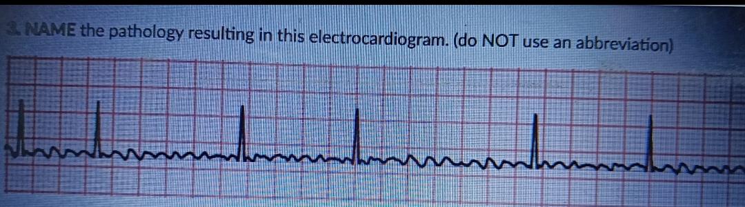3. NAME the pathology resulting in this electrocardiogram. (do NOT use an abbreviation)