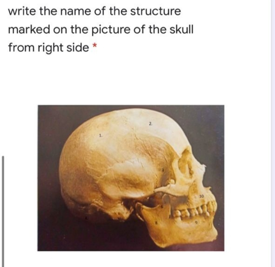 write the name of the structure
marked on the picture of the skull
from right side *
10