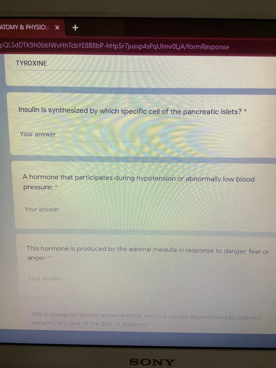 ATOMY & PHYSIOL X
PQLSdDTK9h0bblWvHhTcbYE8B8bP-hHpSr7jusxp4sPqUlmvOLjA/formResponse
TYROXINE
Insulin is synthesized by which specific cell of the pancreatic islets? *
Your answer
A hormone that participates during hypotension or abnormally low blood
pressure: *
Your answer
This hormone is produced by the adrenal medulla in response to danger, fear or
anger:
Your answer
This is characterized by extreme thirst which is usually experienced by diabetic
patients. It is one of the 3P's of diabetes:
SONY
