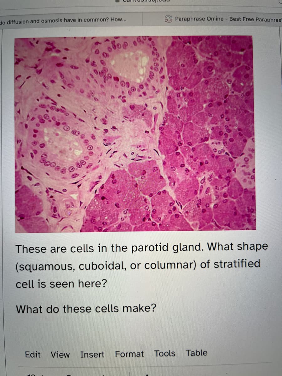 do diffusion and osmosis have in common? How...
Soces
de
Paraphrase Online - Best Free Paraphrasi
These are cells in the parotid gland. What shape
(squamous, cuboidal, or columnar) of stratified
cell is seen here?
What do these cells make?
Edit View Insert Format Tools Table